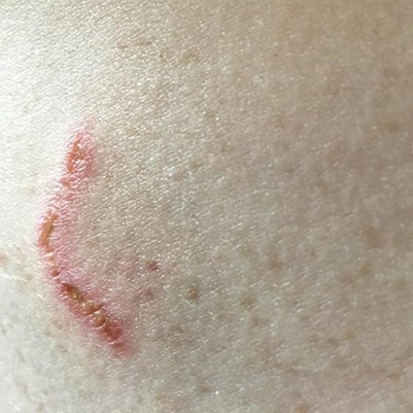 Bio Oil - Picture 4 of 10